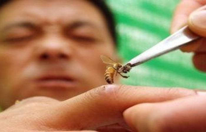 ما تتعالجش بيه.. لسعة النحل قد تسبب الحساسية الشديدة وتؤدى إلى الوفاة