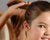 ما هي اسباب تساقط الشعر عند الاطفال؟